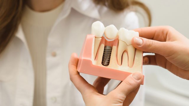 Dental implants in Leominster, MA