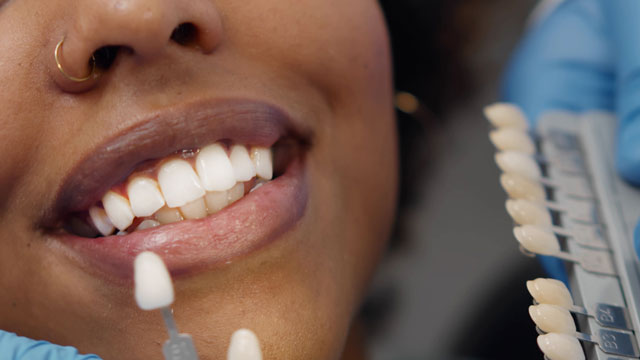 Teeth whitening in Leominster, MA